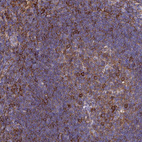 Immunohistochemical staining of human tonsil shows strong membranous positivity in germinal and non germinal center cells.
