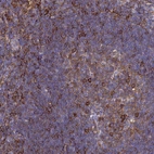 Immunohistochemical staining of human tonsil shows strong membranous positivity in germinal and non germinal center cells.