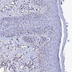 Immunohistochemical staining of human skin shows no positivity in squamous epithelial cells as expected.