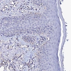 Immunohistochemical staining of human skin shows no positivity in squamous epithelial cells as expected.