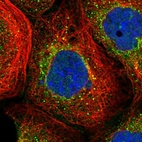 Immunofluorescent staining of human cell line A-431 shows localization to vesicles.