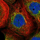 Immunofluorescent staining of human cell line A-431 shows localization to vesicles.