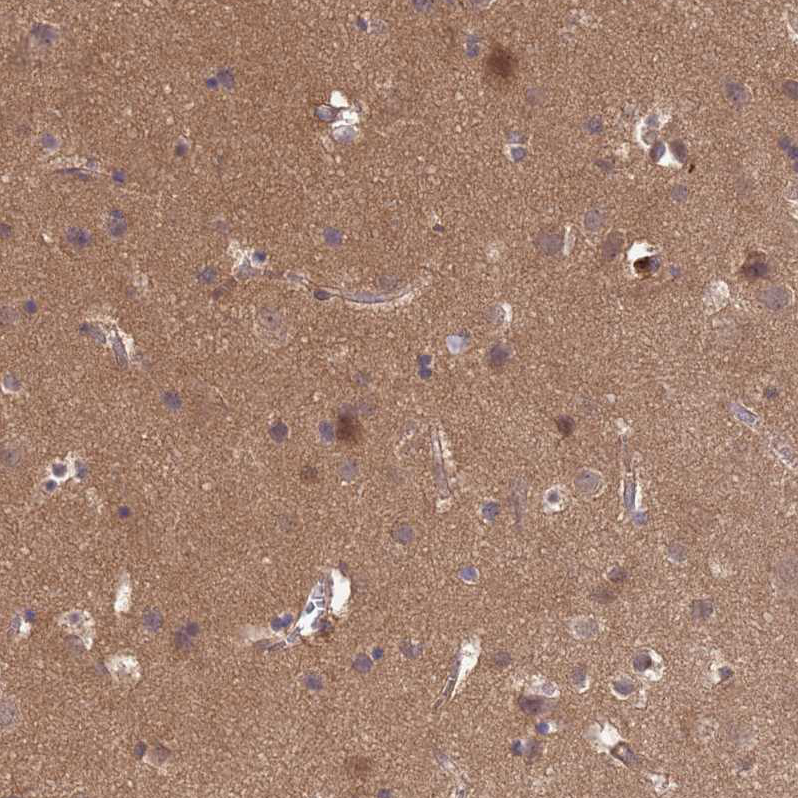 Anti-NPEPPS Antibody