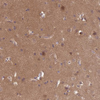 Anti-NPEPPS Antibody