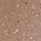 Anti-NPEPPS Antibody