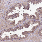 Immunohistochemical staining of human prostate shows weak cytoplasmic positivity in glandular cells.