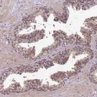 Immunohistochemical staining of human prostate shows weak cytoplasmic positivity in glandular cells.