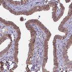 Immunohistochemical staining of human Fallopian tube shows moderate cytoplasmic positivity in glandular cells.