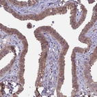 Immunohistochemical staining of human Fallopian tube shows moderate cytoplasmic positivity in glandular cells.