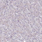 Immunohistochemical staining of human liver shows no positivity in hepatocytes as expected.