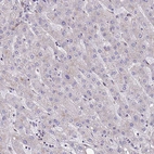 Immunohistochemical staining of human liver shows no positivity in hepatocytes as expected.