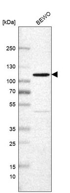 Western blot analysis in human cell line BEWO.