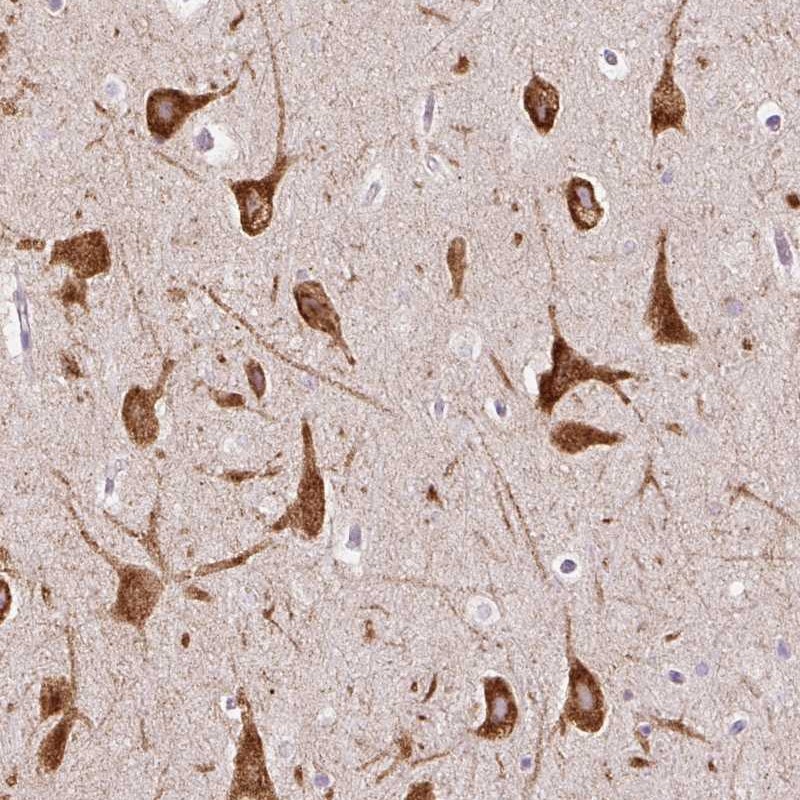 Anti-FMC1 Antibody