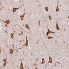 Anti-FMC1 Antibody