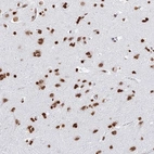 Anti-GBP3 Antibody