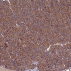 Immunohistochemical staining of human pancreas shows strong cytoplasmic positivity in exocrine glandular cells.