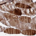 Immunohistochemical staining of human skeletal muscle shows strong cytoplasmic positivity in myocytes.