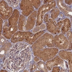 Immunohistochemical staining of human kidney shows strong cytoplasmic positivity in cells in tubules.
