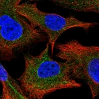 Immunofluorescent staining of human cell line A549 shows localization to cytosol.