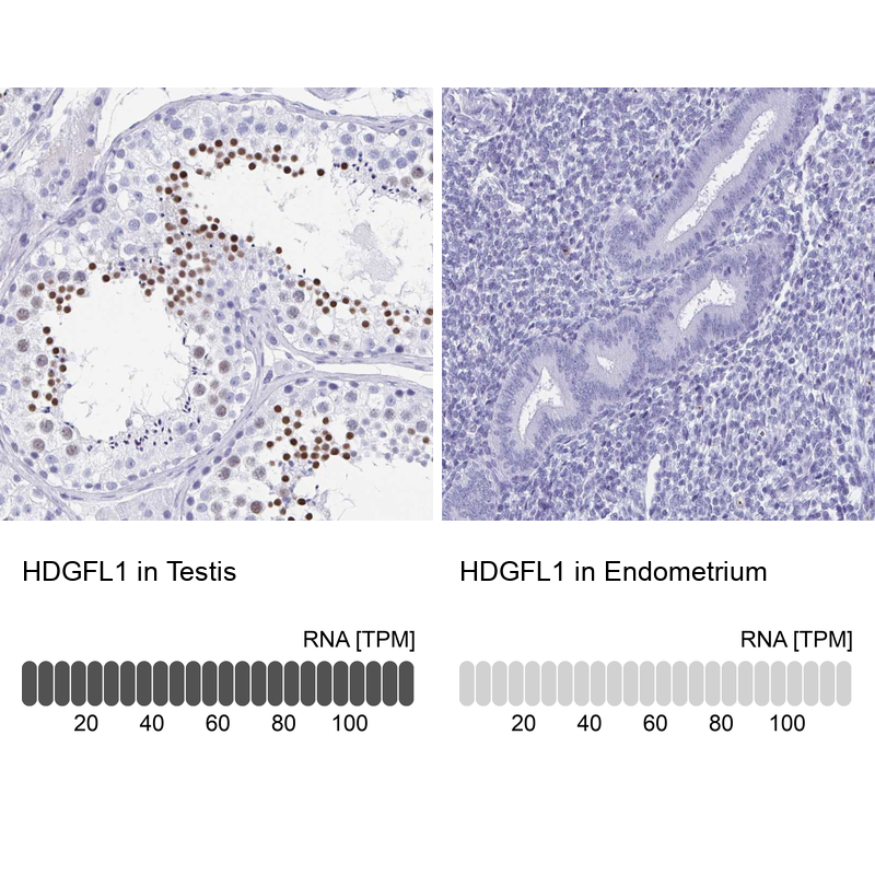 Anti-HDGFL1 Antibody