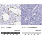 Anti-HDGFL1 Antibody