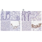 Immunohistochemical staining of human colon, kidney, liver and testis using Anti-HDGFL1 antibody HPA045679 (A) shows similar protein distribution across tissues to independent antibody HPA063707 (B).
