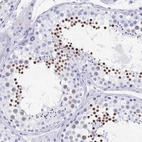 Immunohistochemical staining of human testis shows high expression.