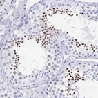 Immunohistochemical staining of human testis shows strong nuclear positivity in spermatids.