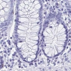 Immunohistochemical staining of human colon using Anti-HDGFL1 antibody HPA045679.