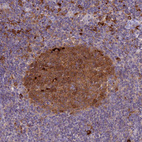 Anti-UBE2G1 Antibody