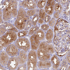 Immunohistochemical staining of human kidney shows moderate cytoplasmic positivity in cells in tubules.