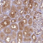 Immunohistochemical staining of human kidney shows moderate cytoplasmic positivity in cells in tubules.