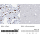 Anti-SSX2 Antibody