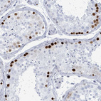 Immunohistochemical staining of human Testis shows strong nuclear positivity in spermatogonia.