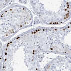 Immunohistochemical staining of human Testis shows strong nuclear positivity in spermatogonia.