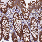 Immunohistochemical staining of human rectum shows moderate cytoplasmic positivity in glandular cells.