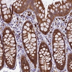 Immunohistochemical staining of human rectum shows moderate cytoplasmic positivity in glandular cells.