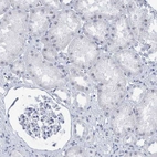 Immunohistochemical staining of human Kidney shows no positivity in cells in tubules as expected.