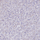 Immunohistochemical staining of human liver shows very weak cytoplasmic positivity in hepatocytes.