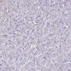 Immunohistochemical staining of human liver shows very weak cytoplasmic positivity in hepatocytes.