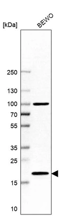 Western blot analysis in human cell line BEWO.