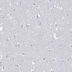 Immunohistochemical staining of human Cerebral cortex shows no positivity in neuronal cells as expected.