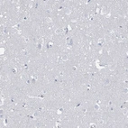 Immunohistochemical staining of human Cerebral cortex shows no positivity in neuronal cells as expected.