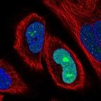 Immunofluorescent staining of human cell line RH-30 shows localization to nucleus & nucleoli.