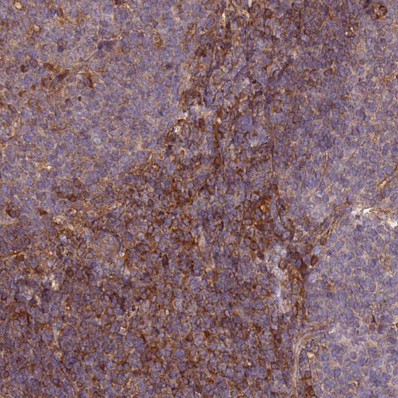 Anti-C17orf62 Antibody