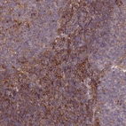 Anti-C17orf62 Antibody