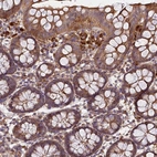 Immunohistochemical staining of human colon shows strong cytoplasmic positivity in lymphoid cells.
