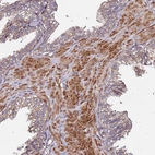 Immunohistochemical staining of human prostate shows moderate to strong membranous positivity in smooth muscle cells.