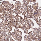 Immunohistochemical staining of human placenta shows moderate cytoplasmic positivity in trophoblastic cells.