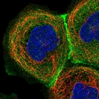 Immunofluorescent staining of human cell line A-431 shows localization to plasma membrane & cell junctions.